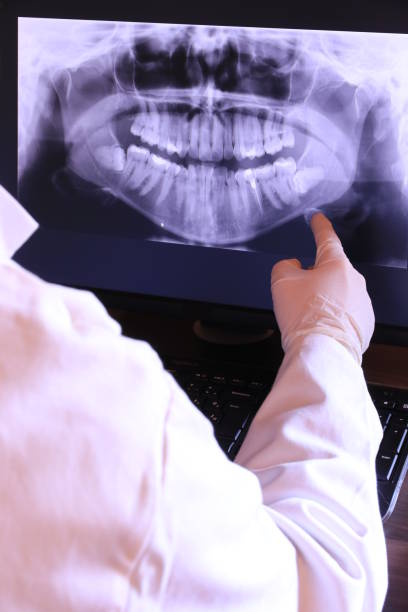 Best Emergency Tooth Extraction  in Fulton, MD